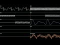 ○♪ Sonic 2 (Prototype) - Neo Green Hill Zone [Oscilloscope View]