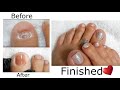 NO Toenails  NO Problem !!  Make POLYGEL TOENAILS w/ Dual Forms ( Yayoge Polygel )