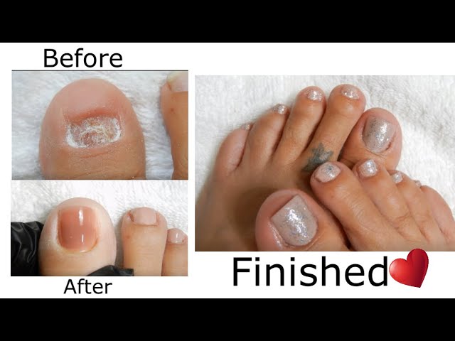 GetUSCart- Sunjasmine Square Press on Toenails, Glossy Fake Toe Nails with  Designs, Short Acrylic False Toes Nails Cute Artificial Full Cover Toenail  for Women (Toenails A5)