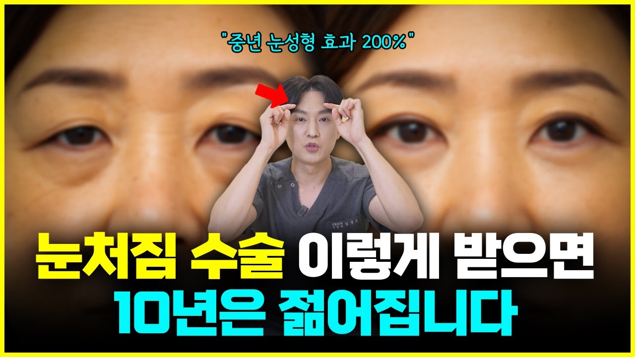눈꺼풀 처짐 이렇게 하시면 10년 젊어집니다 (Feat. 눈꺼풀처짐 수술 효과 및 부작용 수술후 관리법 총정리)