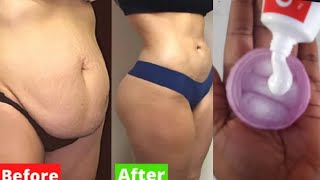 JUST APPLY IT BEFORE BEDTIME & BURN FAT OVERNIGHT |  IN 3 DAYS LOSE YOUR WEIGHT FAST