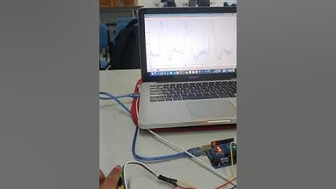 Pulse Sensor interfaced with Arduino