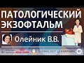 Патологический экзофтальм