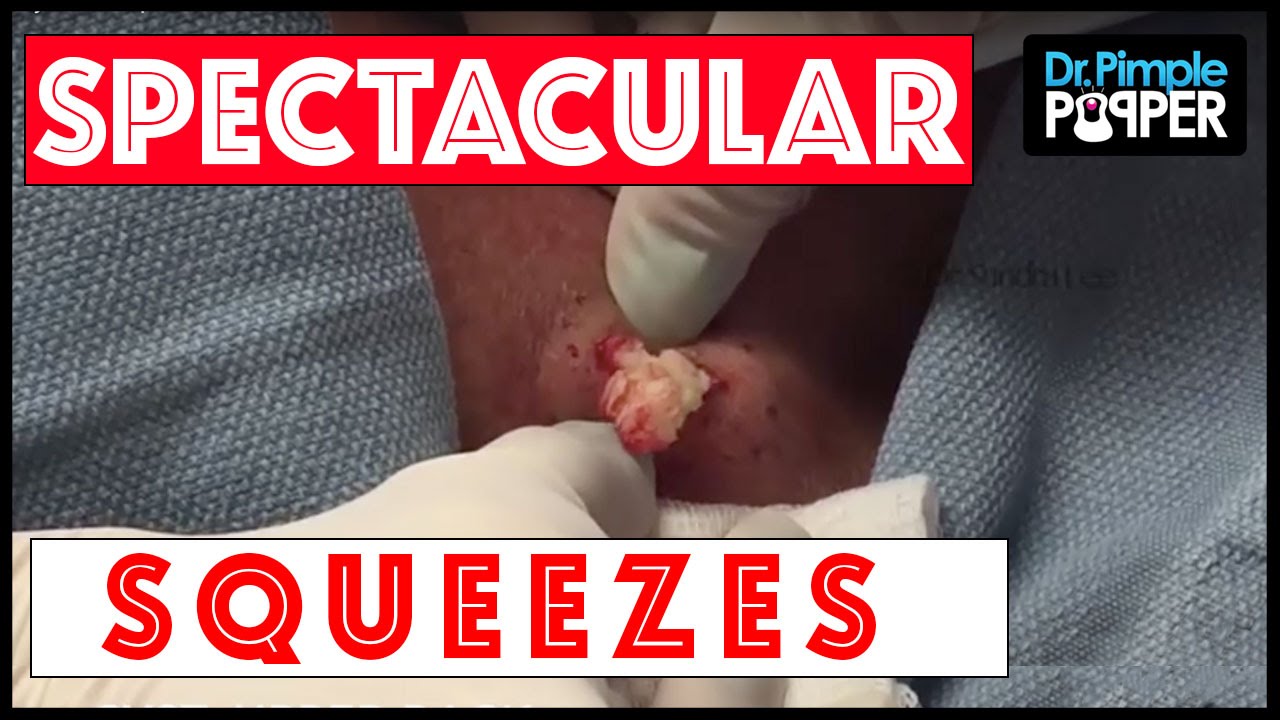 WEB EXCLUSIVE: Some of My Most Spectacular Squeezes! - Published on Oct 8, 2015