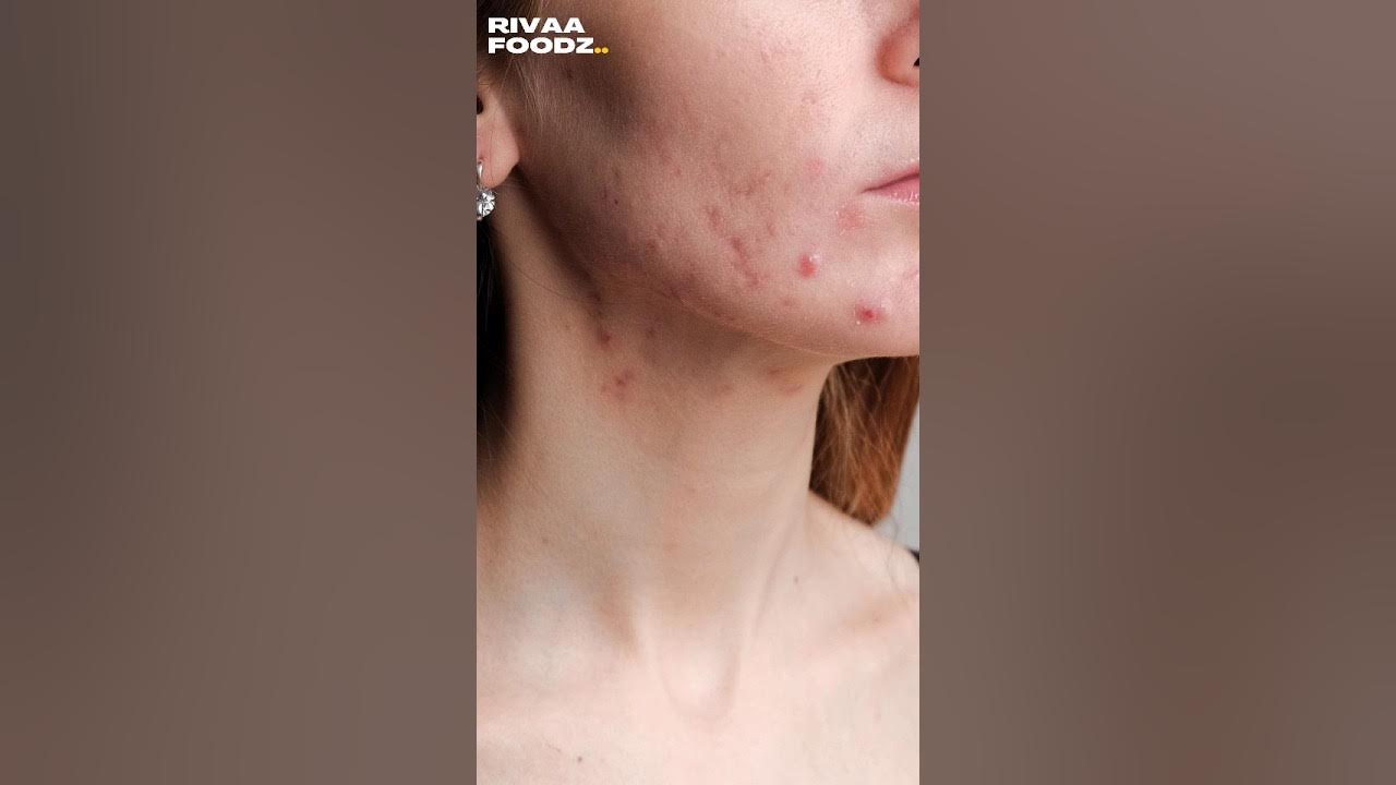 can-vitamin-c-cause-skin-irritation-youtube