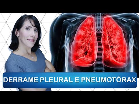 Derrame Pleural e Pneumotórax