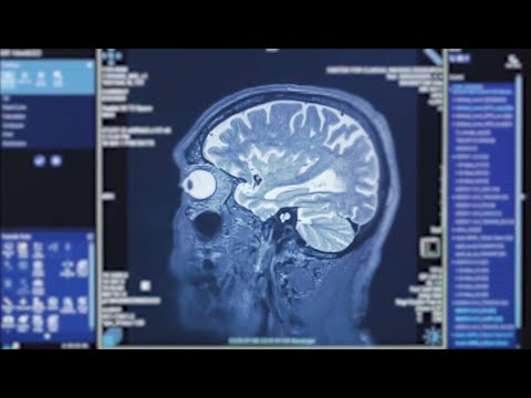 Brain inflammation triggers extreme muscle weakness through pathway scientists hope to stop