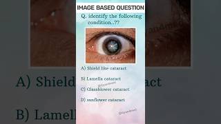 Image Based Question 72