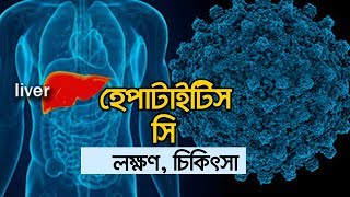 হেপাটাইটিস সি এর লক্ষণ, রোগ নির্ণয় ও চিকিৎসা । হেপাটাইটিস সি লক্ষণসমূহ। screenshot 5