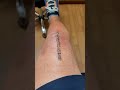 My total knee replacement was done on monday, june eighth and recovery has been a Breeze