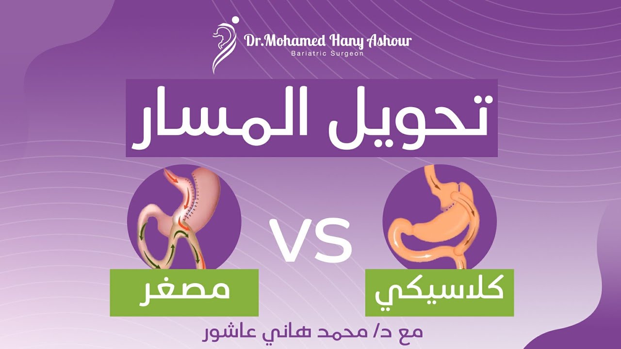 الفرق بين عملية تحويل المسار الكلاسيكي والمصغر