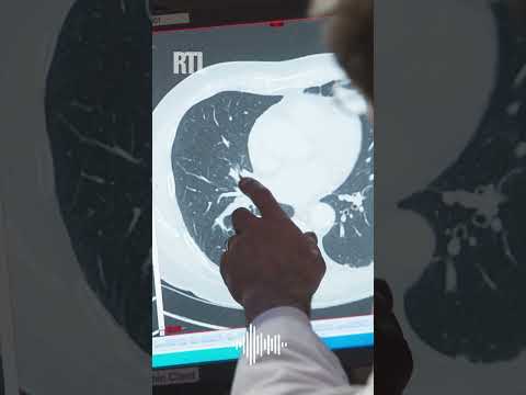 Vidéo: Le cancer de la prostate apparaîtrait-il sur un scanner ?