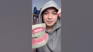 Di Kota kamu TARIF PERDA (PERaturan DAerah) untuk perawatan cabut gigi berapa harganya?