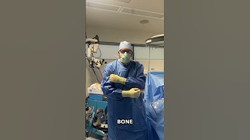 Shoulder Arthroscopy for Biceps Tendon Injury and Pain#shoulderpain #bicep #injury