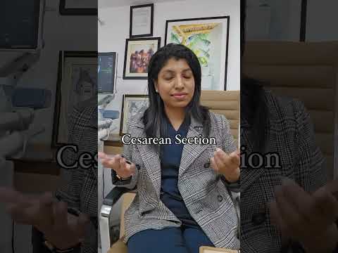 Normal Vs Cesarean