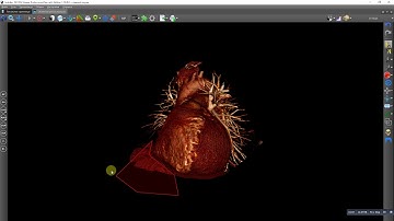 Volume segmentation using contour cutting