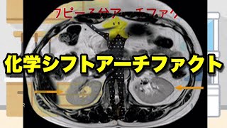 絶対科学への行程 岡山大学】火星の気候変動の足跡：中緯度クレーターに記録された