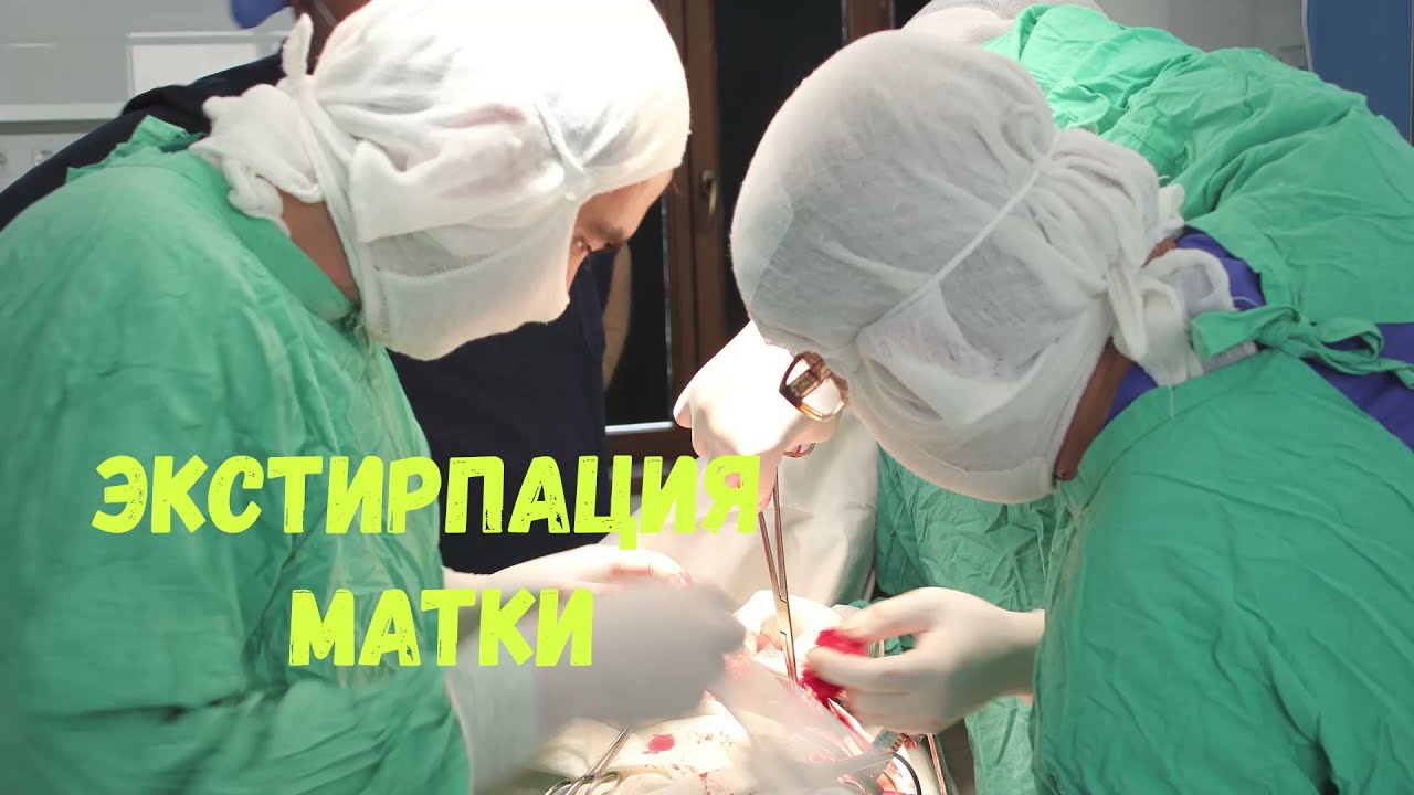 Экстирпация матки с придатками. Операция, показания. - YouTube