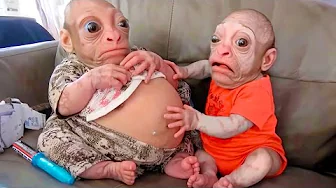 Most Unusual Couples Proving That Love Is Blind