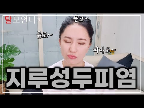 반복하고 재발하는 지루성두피염 치료 방법! 머리가 가렵고, 비듬이 생기고 증상이 보이면 이렇게 하세요! #탈모관리 #두피관리 전문 탈모언니TV