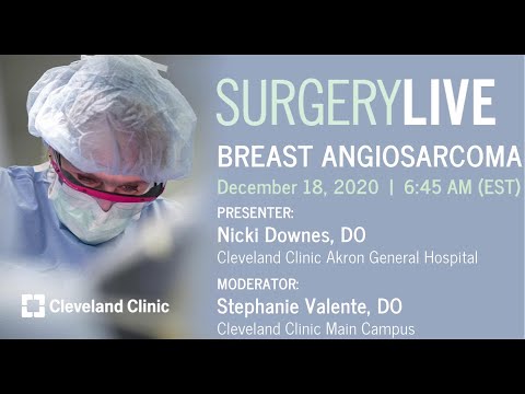 Breast Angiosarcoma (Graphic)