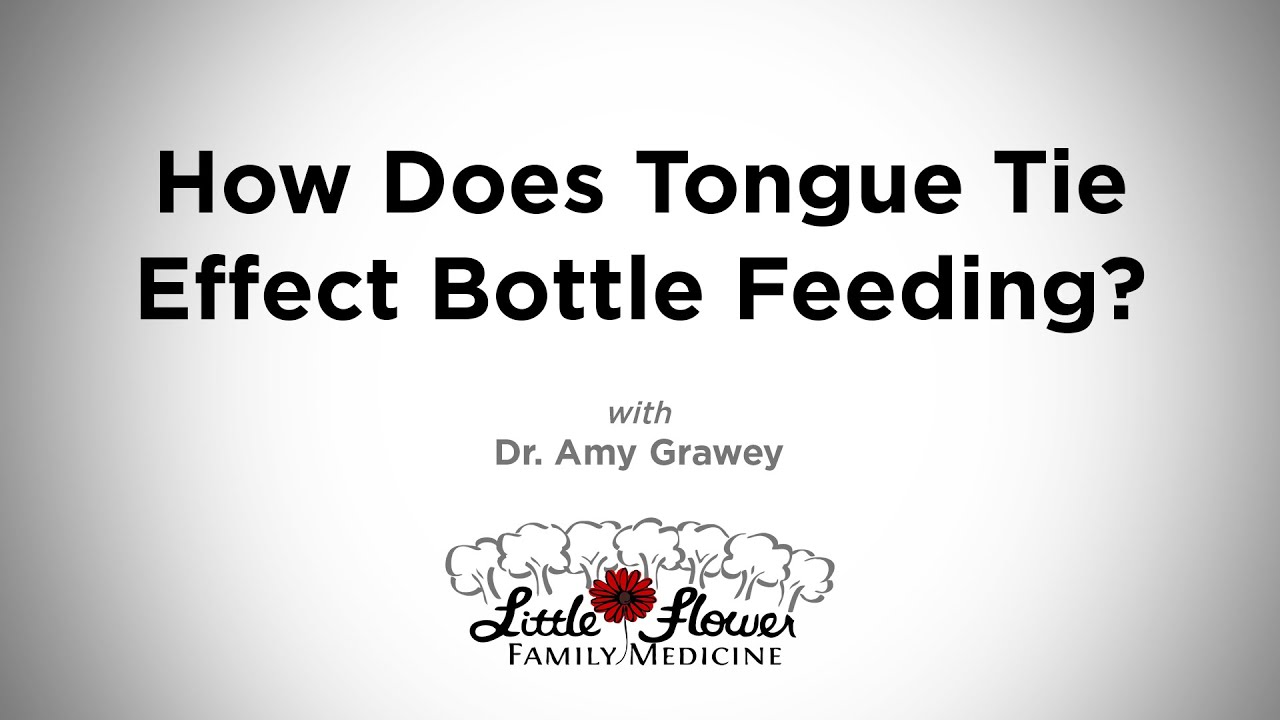 How Does Tongue Tie Effect Bottle Feeding? YouTube