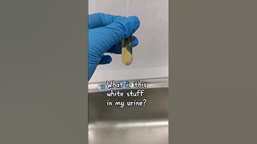 Do you see the white stuff in urine #laboratory #microscope #urinalysis #urinesediment #urinecrystal
