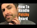 How To Deal With A Patchy Beard | Bald Spot Reduction Tips