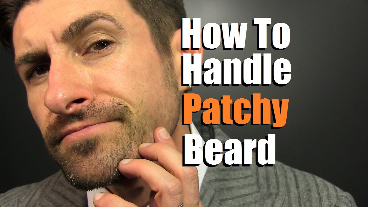 Bald rogaine spots beard for Definitive Guide