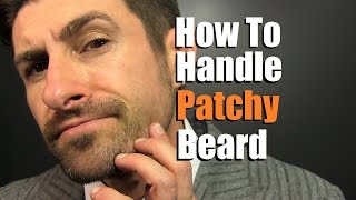 How To Deal With A Patchy Beard | Bald Spot Reduction Tips screenshot 2