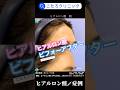 【こたろクリニック】ヒアルロン酸ビフォーアフター #皮膚科 #美容 #シワ