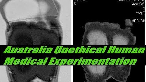 Wireless Body Area Network (WBAN) Virtual healthcare service