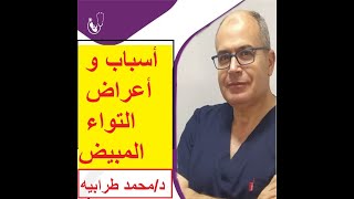 أسباب و اعراض إلتواء المبيض . #دكتور_محمد_طرابيه