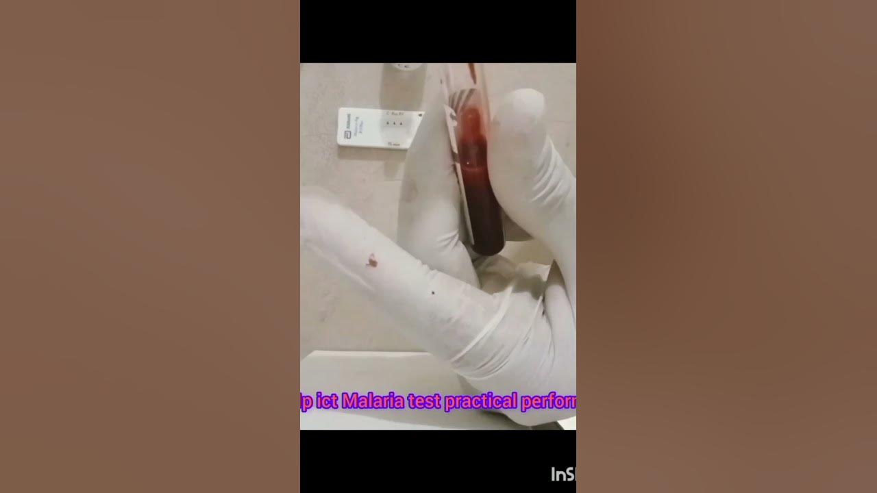 mp-ict-malaria-test-practical-perform-shorts-viral-trending