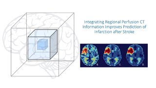Integrating Regional Perfusion CT Information Improves Prediction of Infarction after Stroke