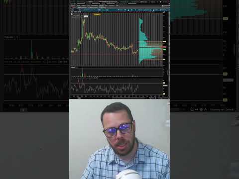 AMC Stock Technical