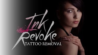 How Tattoo Removal Works: Simple Explanation!