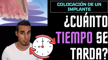 ¿Cuáles son las etapas de la colocación de un implante dental?