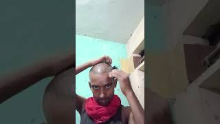 derma roller