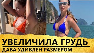 Ольга Бузова сделала грудь для Давида Манукяна [увеличила грудь в Тайланде]