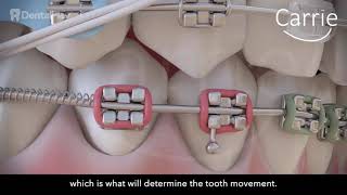 Orthodontics: Elements of the Orthodontics and its Role