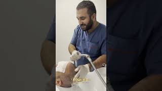 Saç Ekimi 10. Gün Yıkama - Kabuk Dökümü - The Hair Clinic - Ahmet Tosun