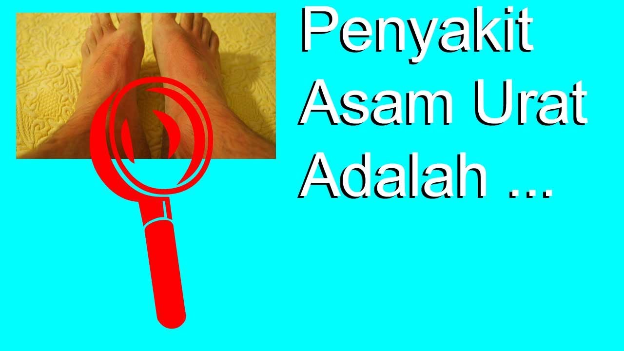 Tips Jitu Turunkan Asam Urat Secara Alami Tips Jitu Turunkan Asam Urat Secara Alami