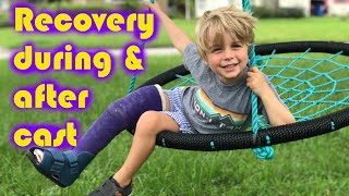 TODDLER BROKEN LEG, CAST, & RECOVERY | What to expect