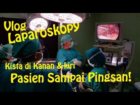 Video: Laparoskopi Kista Ovarium: Bagaimana Operasi Pengangkatan, Konsekuensinya