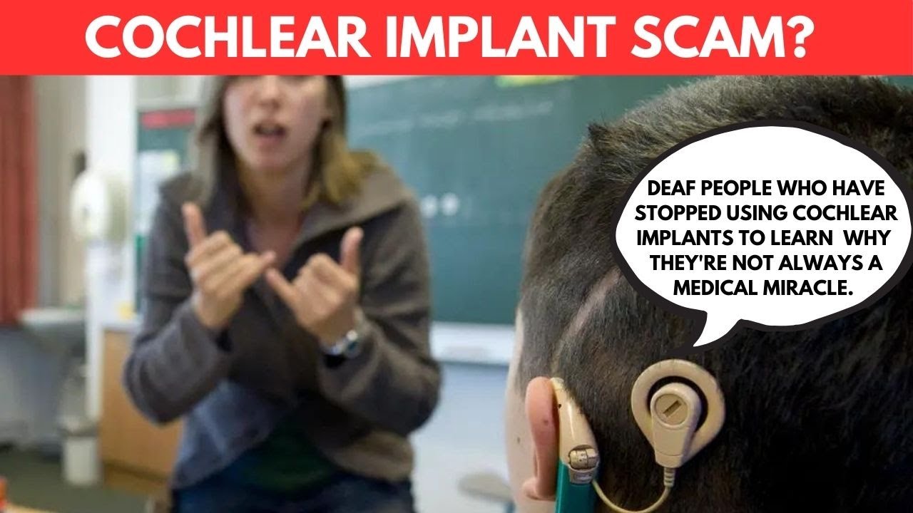 cochlear implant scam?