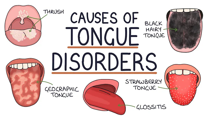 Understanding Tongue Disorders: Causes and Management - DayDayNews