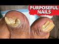 Trimming EXTREMELY THICK Nails