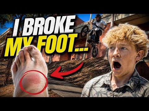 I broke my foot on an ETM RTR 🫪