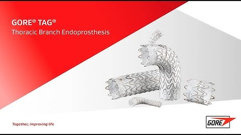 Thoracic branch animation